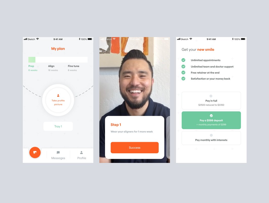 Before: the old app — My plan, aligner step with a 'Success' button, plan choice